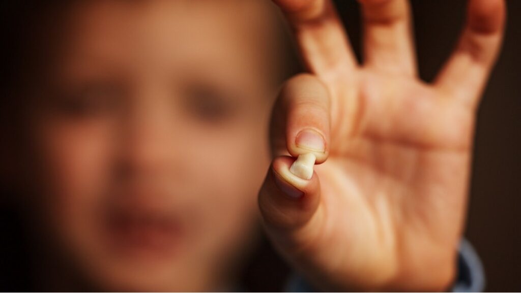 Sonhar com dente