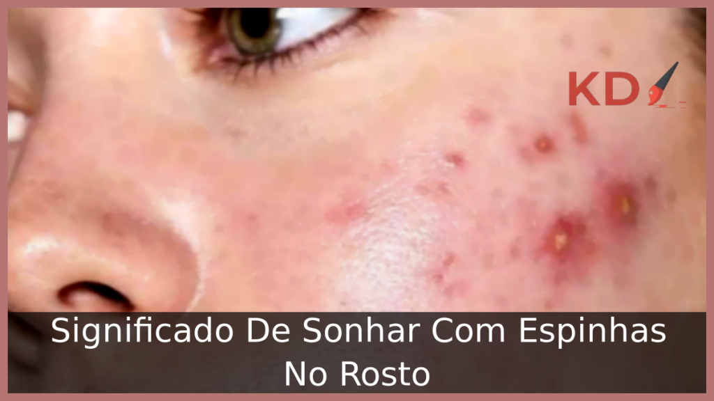 Significado De Sonhar Com Espinhas No Rosto 1 Sonhar Com Espinhas No Rosto