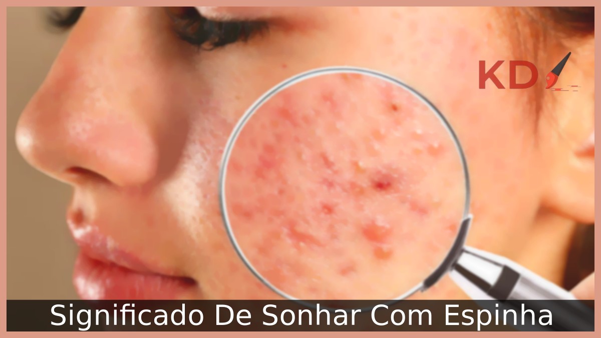Sonhar Com Espinha: Significado real! 5 Sonhar Com Espinha